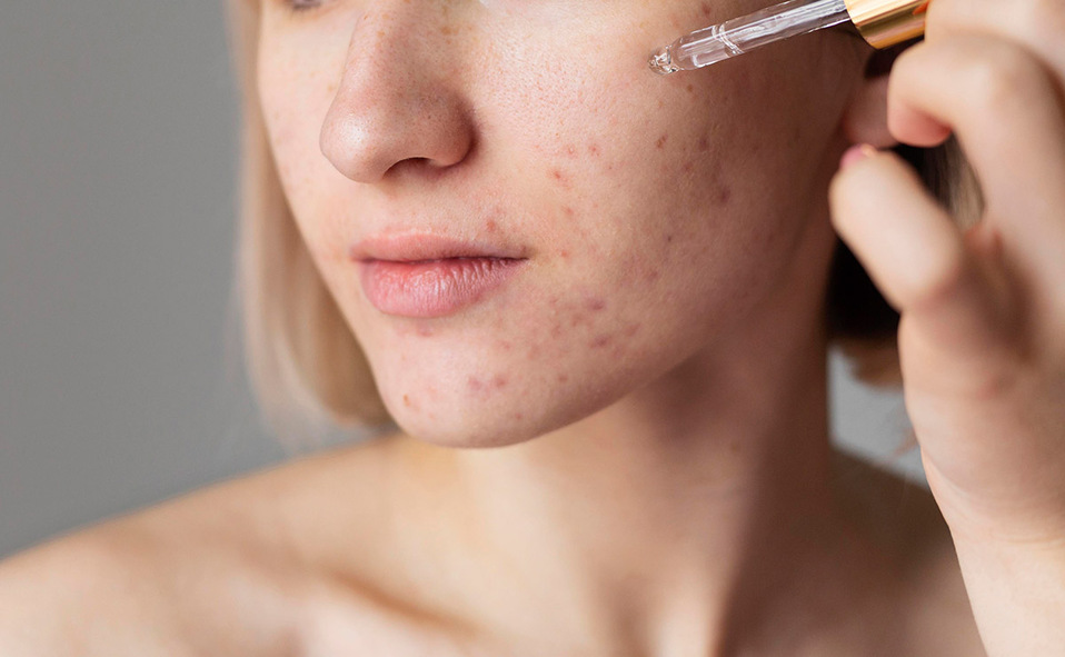 Revive tu piel con la tendencia de skincare de los 90s