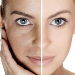 Revolución en cuidado de piel: Tecnología de skincare