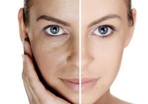 Revolución en cuidado de piel: Tecnología de skincare