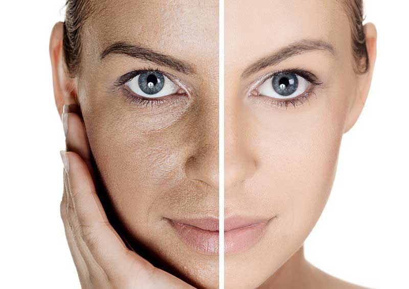 Revolución en cuidado de piel: Tecnología de skincare