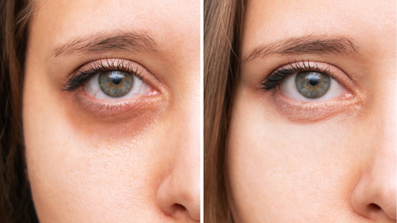 Rutina de cuidado facial en tus 20s: ¡luce radiante!