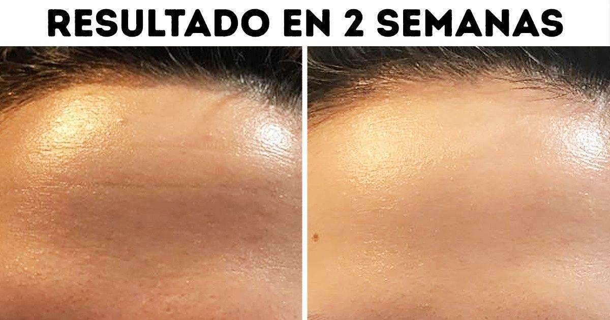 Secretos japoneses para una piel radiante en Reddit