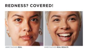 Transforma tu piel con It Cosmetics: cuidado de la piel de lujo