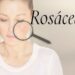 Transforma tu piel con nuestra rutina skincare para rosacea