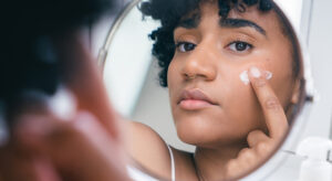 Transforma tu piel con Skincare Ordinary: ¡adiós a las imperfecciones!