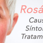 Tratamiento efectivo para la rosácea con nuestra rutina de skincare