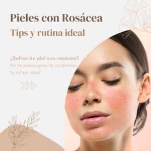 Tratamiento efectivo para la rosácea: cuidado de la piel