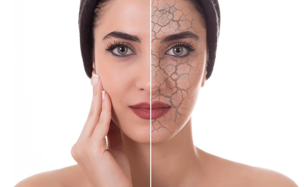 Una piel libre de acné con una rutina efectiva